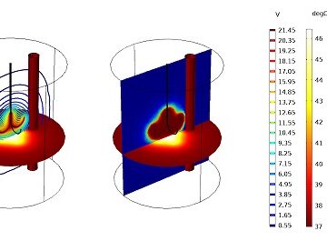 هایپرترمی اثرات بیولوژیکی گرما در درمان سرطان کامسول 1