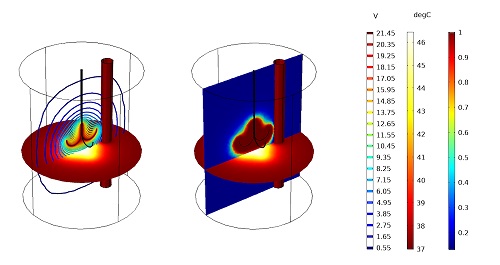 هایپرترمی اثرات بیولوژیکی گرما در درمان سرطان کامسول 1
